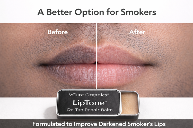 Smoker’s Lip Repair