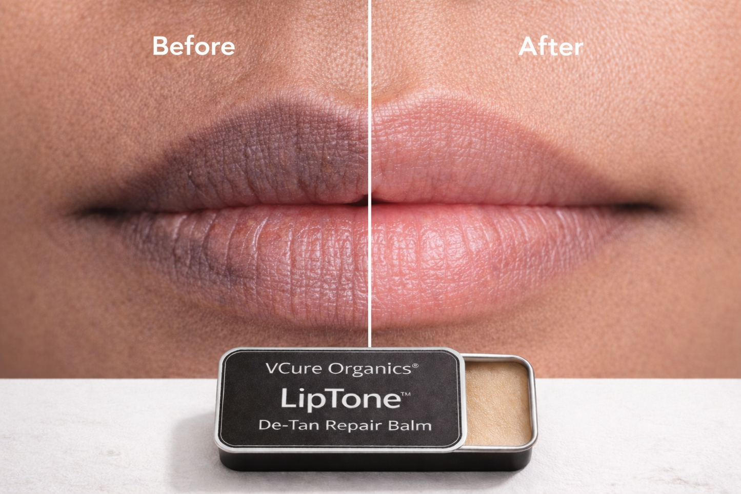 VCure Organics® LipTone™ De-Tan Repair Balm | Kojic Dipalmitate Lip Pigmentation Repair | Hydrating & Tone-Correcting Lip Balm