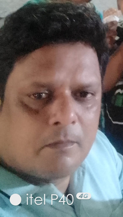 Before using VCure Gluta Glow Duo — Brightening & Hydrating Skincare Kit