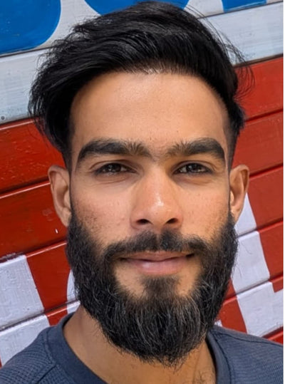 After using VCure Gluta Glow Duo — Brightening & Hydrating Skincare Kit